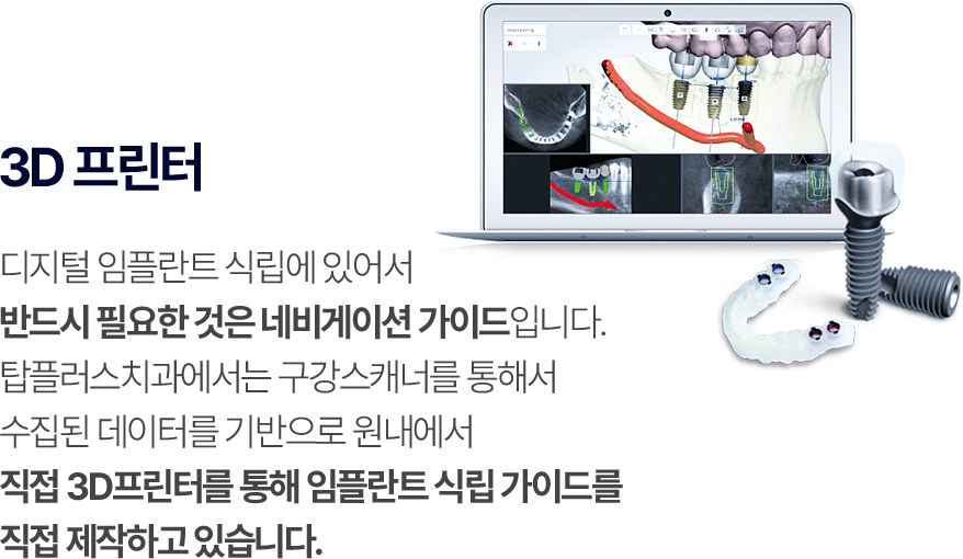 3D 프린터